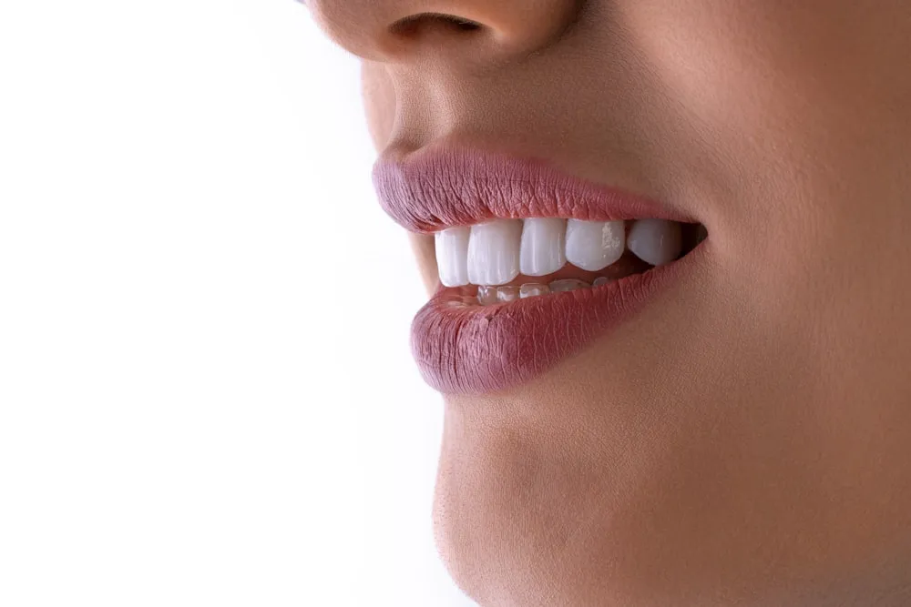Primer plano de una sonrisa tras un diseño dental
